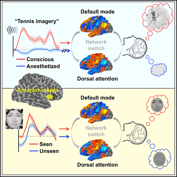 Consciousness-anterior insula